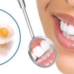 Do I need a dental crown?