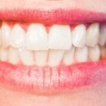 Is all that teeth grinding and clenching causing damage?