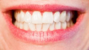 Grinding Teeth - Clenching Teeth - Teeth Wear